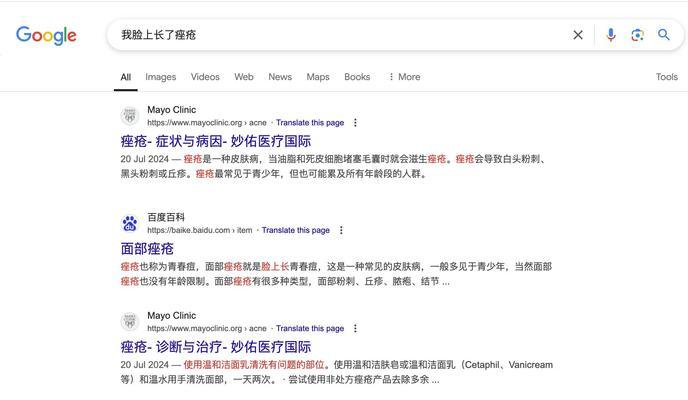 百科答题搜索引擎是什么？有什么功能？